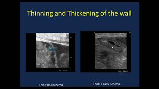 Point of Care Neonatal Ultrasound [upl. by Dulci]