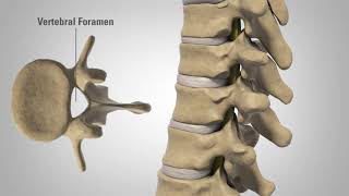 Myelopathy  Patient Education [upl. by Ranchod]