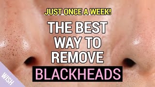 Ultimate Blackhead Removal amp Preventing Tips  How to Remove Blackheads Properly [upl. by Mishaan745]