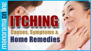 Itching Causes Home Remedies  Health Tips  Manorama Online [upl. by Hailed]