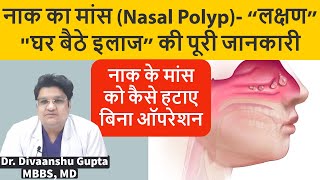 Nasal Polyps नाक के बढे हुए मांस का इलाज कैसे करे  Naak me Maas ka Badhna Nasal Polyps Treatment [upl. by Akenna]