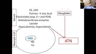 What is rhabdomyolysis [upl. by Donoho]