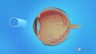 Peripheral Vision and Central Vision in the Retina [upl. by Rhys]