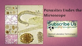 Parasites Under The Microscope [upl. by Miehar]