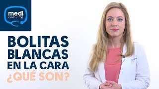 Bolitas blancas en la cara ¿qué son MediConsultas [upl. by Agneta]