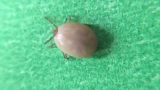 Tick Flicks  Deer Tick [upl. by Joed891]