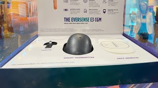 Eversense The 180day Implantable CGM  CEO Interview [upl. by Elades]