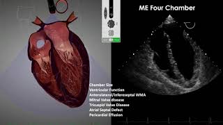 Transesophageal Echocardiography TEE Imaging [upl. by Colson678]