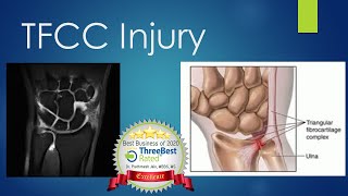 TFCC Injury How Problem Treatment Diagnosis [upl. by Ylrehc]