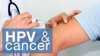 HPV amp cancer [upl. by Bore655]