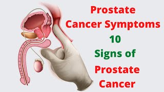 What Is a Normal PSA for a Man Without Prostate Cancer  Ask a Prostate Expert Mark Scholz MD [upl. by Sivartal]