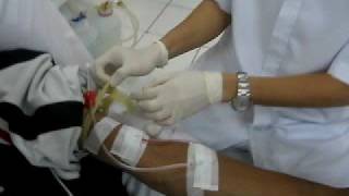 HEMODIALYSIS Procedure [upl. by Yolanthe]