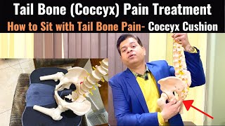 Tailbone Pain Relief Treatment Coccydynia Coccyx Seat Cushion Tail bone Exercises Sitting Pain [upl. by Ahker]