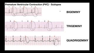 Difference between PVC cPVC uPVC and PEX [upl. by Ziegler190]