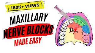 Maxillary Nerve Block Anesthesia For Dental Procedures [upl. by Akerdna]