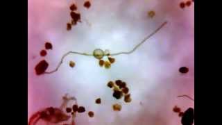 Isolation of arbuscular mycorrhizal spores [upl. by Viridis]