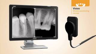 Dental Sensor  Owandy Visteo new concept in Digital Radiography [upl. by Dymoke]