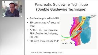 ERCP removal of migrated cbd stent [upl. by Eileen]