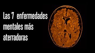 Las 7 enfermedades mentales más aterradoras [upl. by Lateehs804]