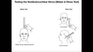 Interpreting the WeberRinne Tests EXPLAINED [upl. by Lleddaw950]