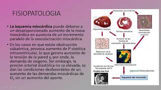 Miocardiopatía Hipertrófica [upl. by Christyna]