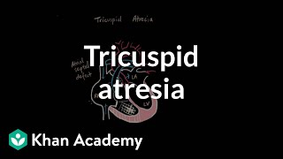 Tricuspid atresia  Circulatory System and Disease  NCLEXRN  Khan Academy [upl. by Alyk531]