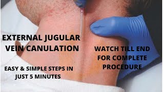 EXTERNAL JUGULAR VEIN CANNULATION PROCEDURE WITH SIMPLIFIED STEPS [upl. by Camellia685]