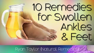 10 Home Remedies for Swollen Feet and Ankles [upl. by Figueroa]