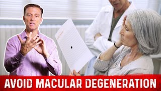 How to Prevent Macular Degeneration – Dr Berg [upl. by Ramma]