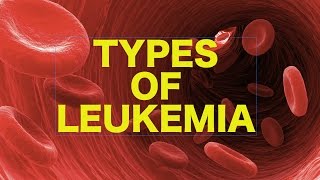 Leukemia  USMLE [upl. by Rabi]