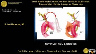 Gastrointestinal  Liver Circulation amp Portal Hypertension [upl. by Idnahs]