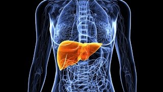 Primary Biliary Cirrhosis [upl. by Airetak]