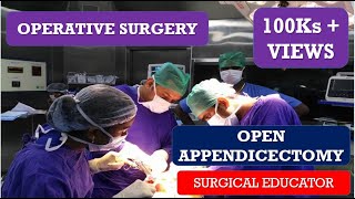 OPEN APPENDECTOMY STEP BY STEP OPERATIVE SURGERY [upl. by Anayi77]