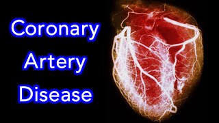 Coronary Artery Disease CAD Animation  MADE EASY [upl. by Peggir466]