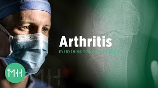 What is Arthritis  Everything You Need to Know About Arthritis [upl. by Nyladnar]