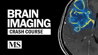 Brain Imaging Crash Course [upl. by Lilllie]