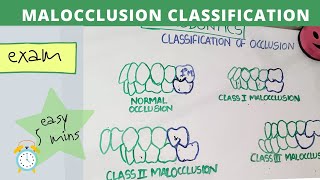 malocclusion of teeth I orthodontics lecture [upl. by Anailil]