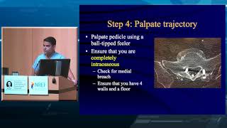 Lumbar Pedicle Screw Placement [upl. by Robma]