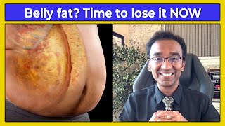 How to lose belly fat NATURALLY without complex dieting  DAWN  DUSK method to BURN fat [upl. by Marguerita]