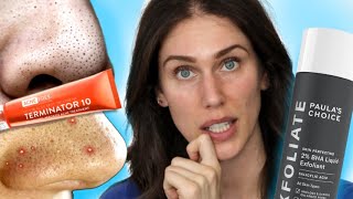 What causes acne and how you can prevent it [upl. by Karlens]