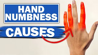 Numbness in Fingers and Toes  Dr Mark LeDoux  Top10MD [upl. by Eatnoed]