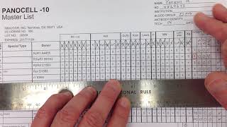 Blood Bank  Antibody Identification I [upl. by Caron]