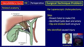 Cholecystectomy Risks and Side Effects [upl. by Nossaj]