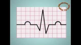 Understanding ECGs  EKG [upl. by Ojyllek]