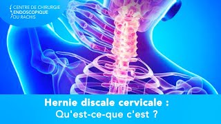 HERNIE DISCALE CERVICALE  Questceque cest [upl. by Madriene]