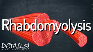 Rhabdomyolysis  Details [upl. by Eelan777]