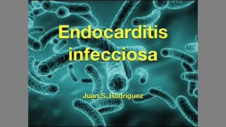 Endocarditis infecciosa [upl. by Faustus]