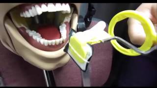 Posterior Periapical Mandibular Placement [upl. by Attenna]