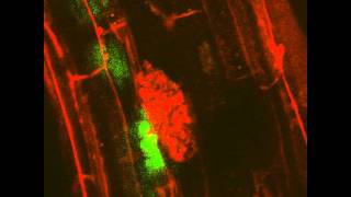 Arbuscular Mycorrhizal Symbiosis VESICLE Live Imaging [upl. by Areval]