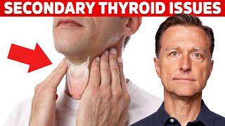 Most Thyroid Issues Are Secondary to Other Problems – Dr Berg [upl. by Ellirpa]